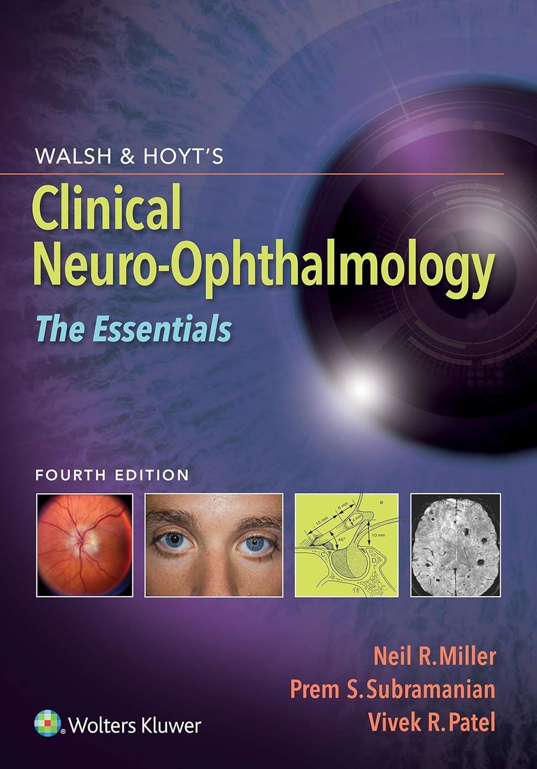 Walsh & Hoyt’s Clinical Neuro-Ophthalmology: The Essentials