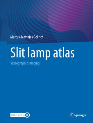 Slit lamp atlas, 2025th Edition