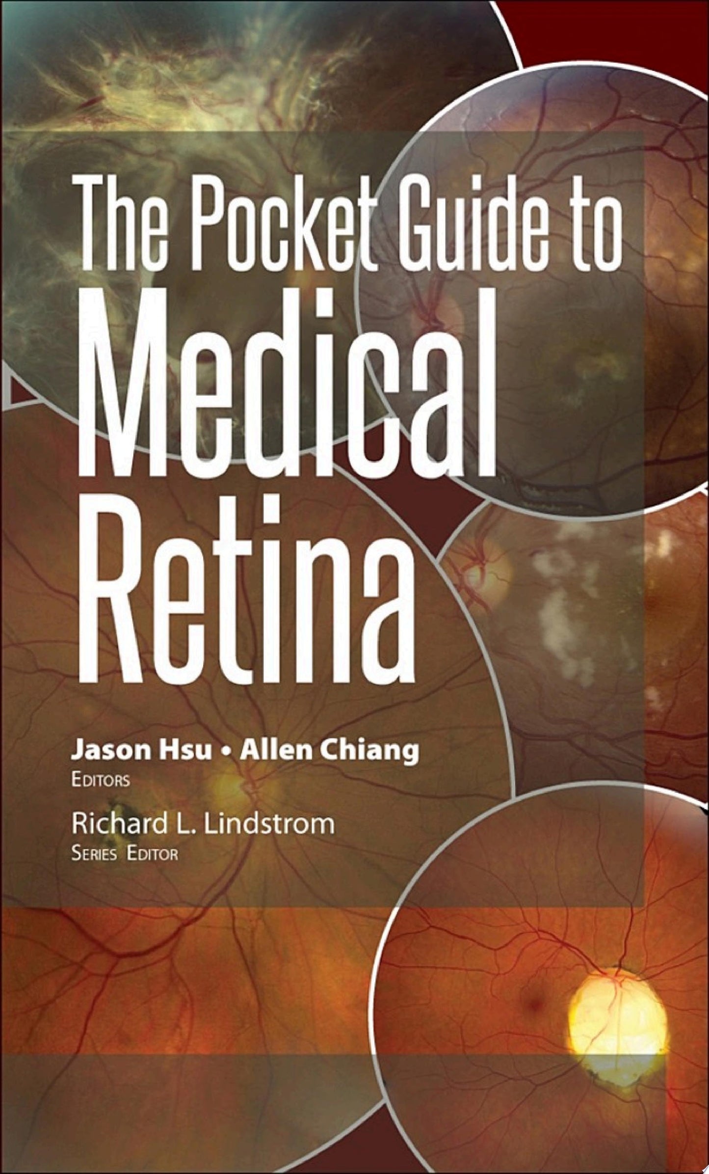 The Pocket Guide to Medical Retina