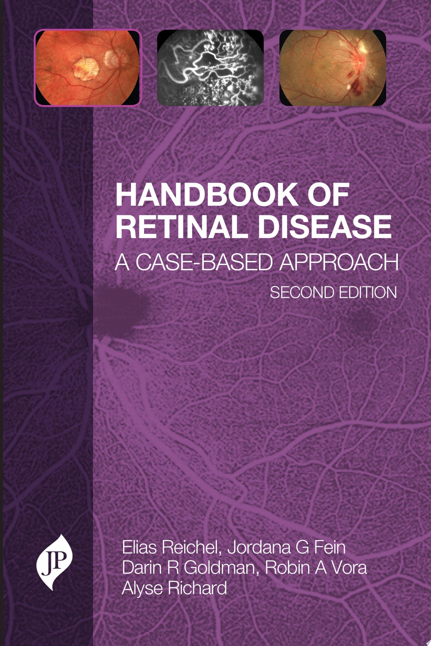 Handbook of Retinal Disease: A Case- Based Approach, 2ed