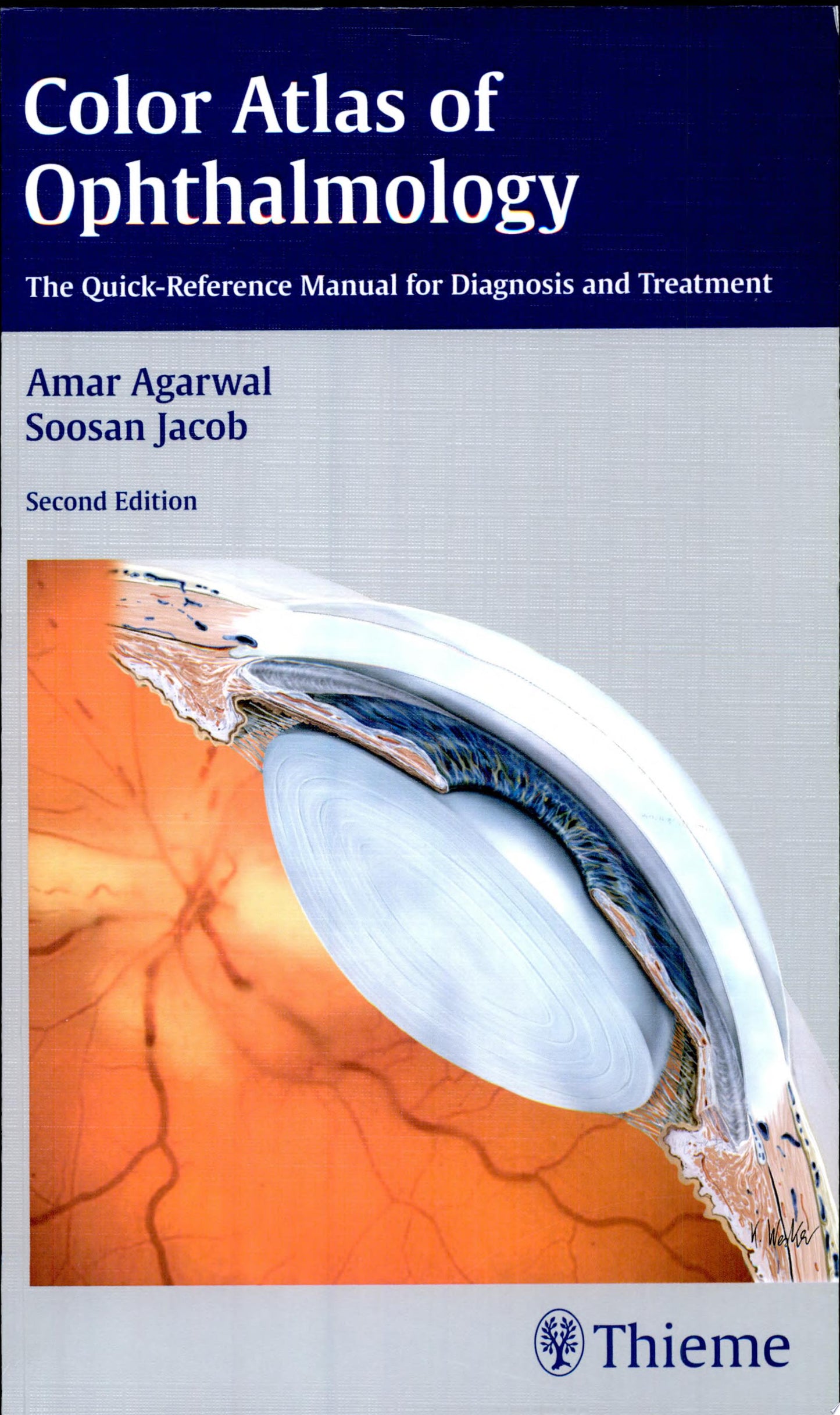 Color Atlas of Ophthalmology: The Quick-Reference Manual for Diagnosis and Treatment, 2nd Edition