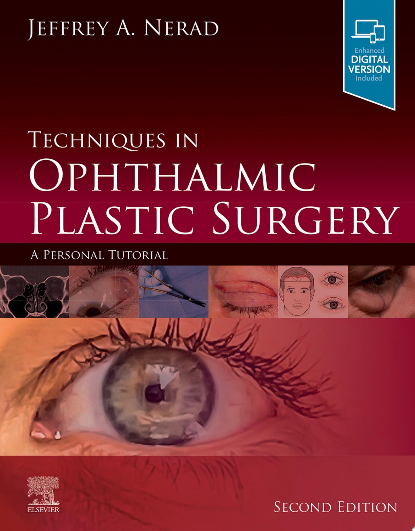 Techniques in Ophthalmic Plastic Surgery: A Personal Tutorial, 2nd Edition