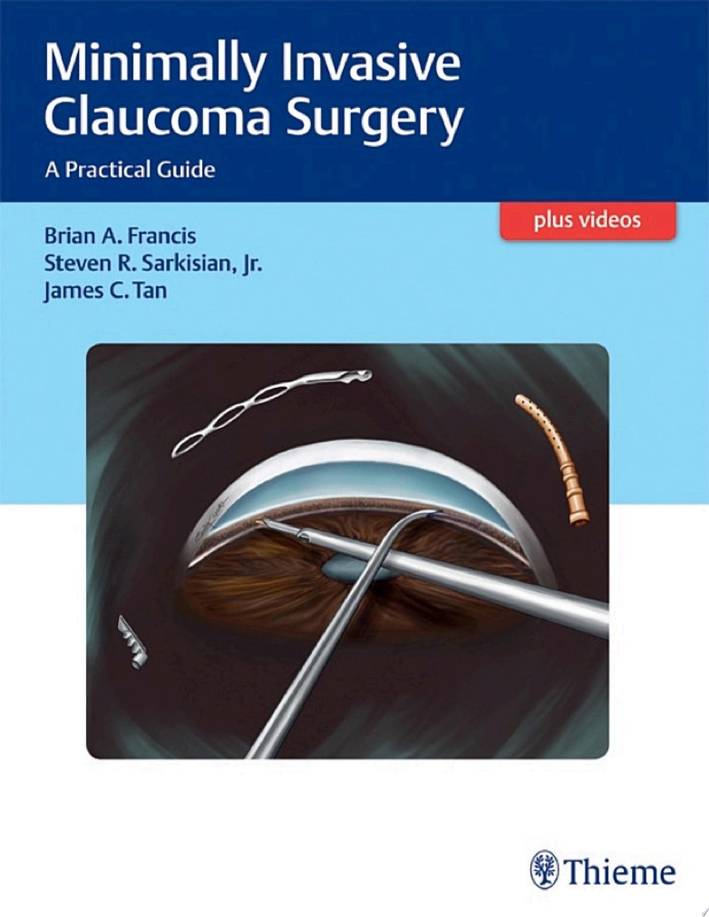 Minimally Invasive Glaucoma Surgery: A Practical Guide