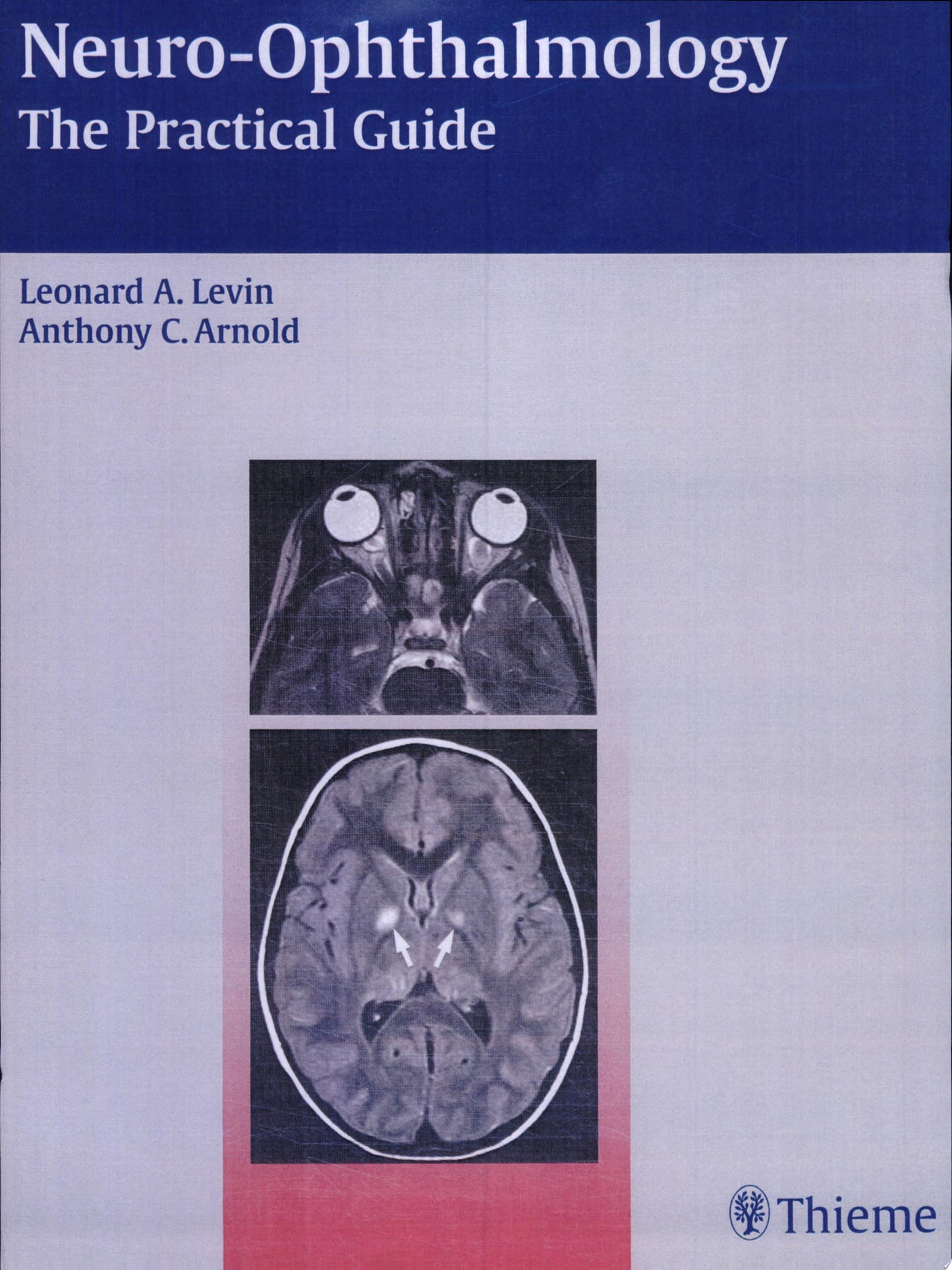Neuro-Ophthalmology: The Practical Guide