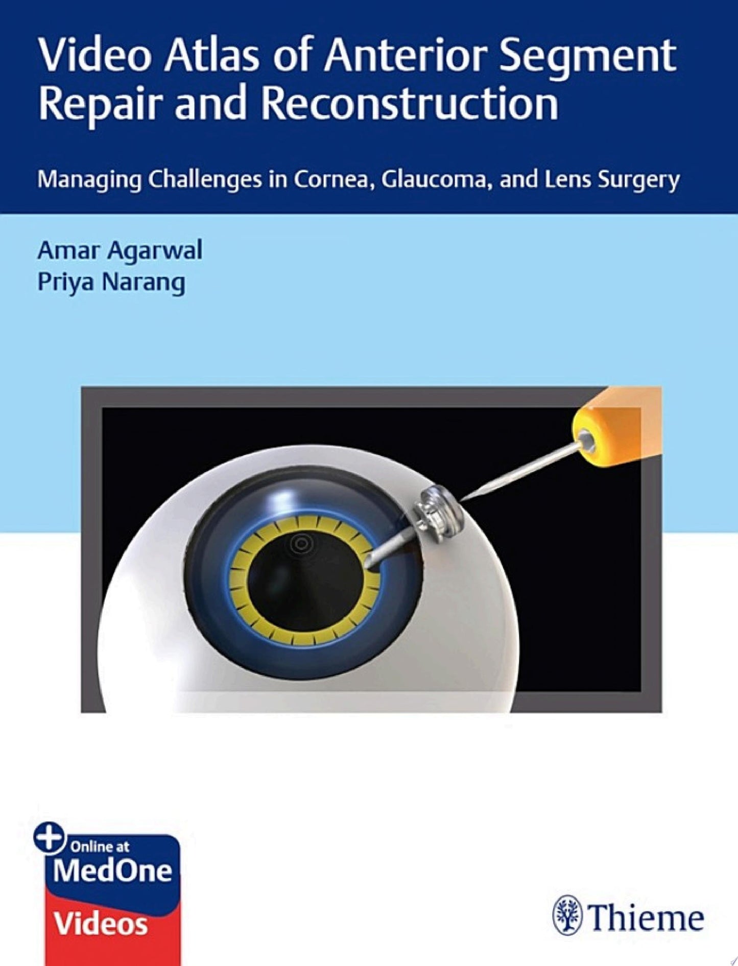 Video Atlas of Anterior Segment Repair and Reconstruction: Managing Challenges in Cornea, Glaucoma, and Lens Surgery