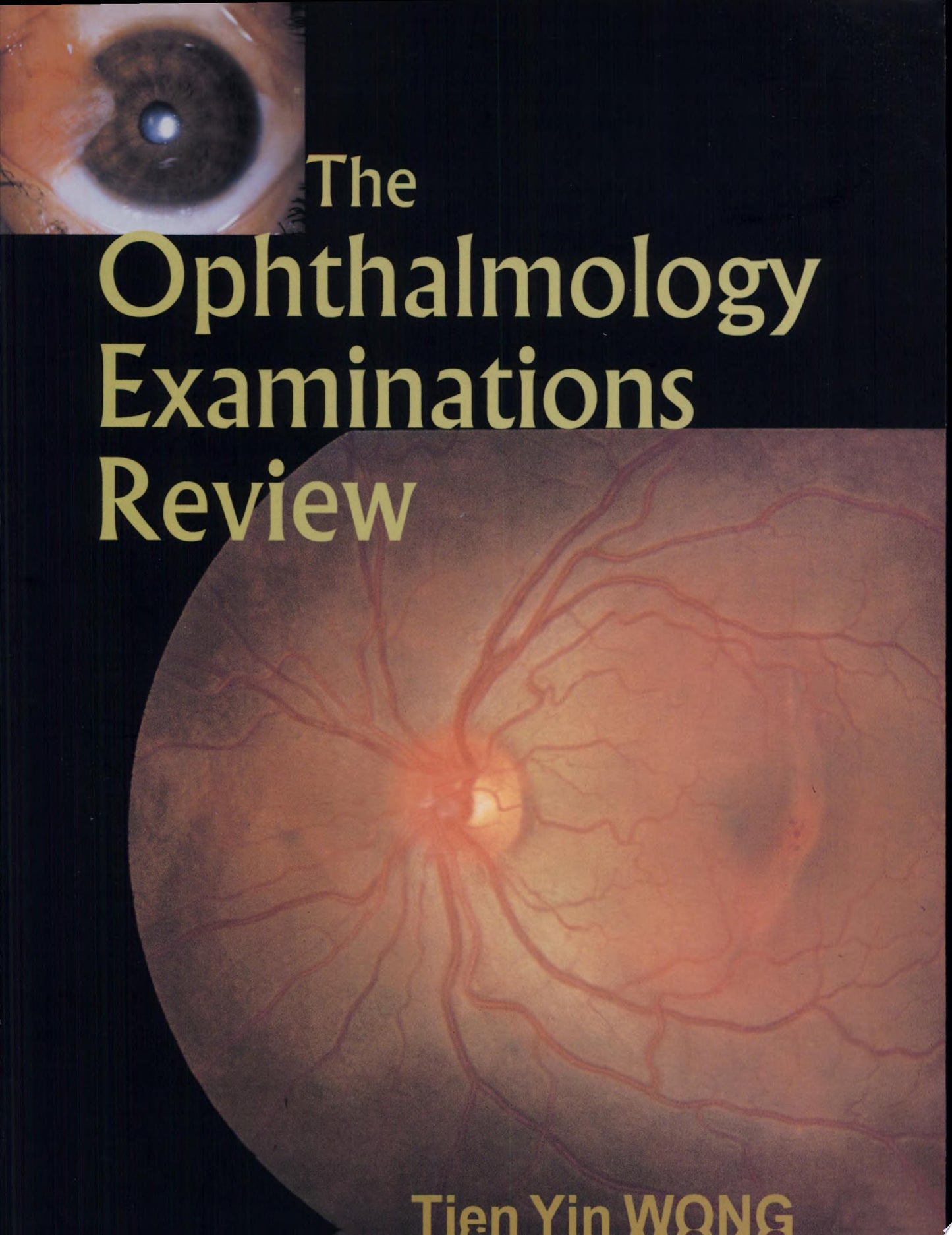Ophthalmology Review, 3rd edition