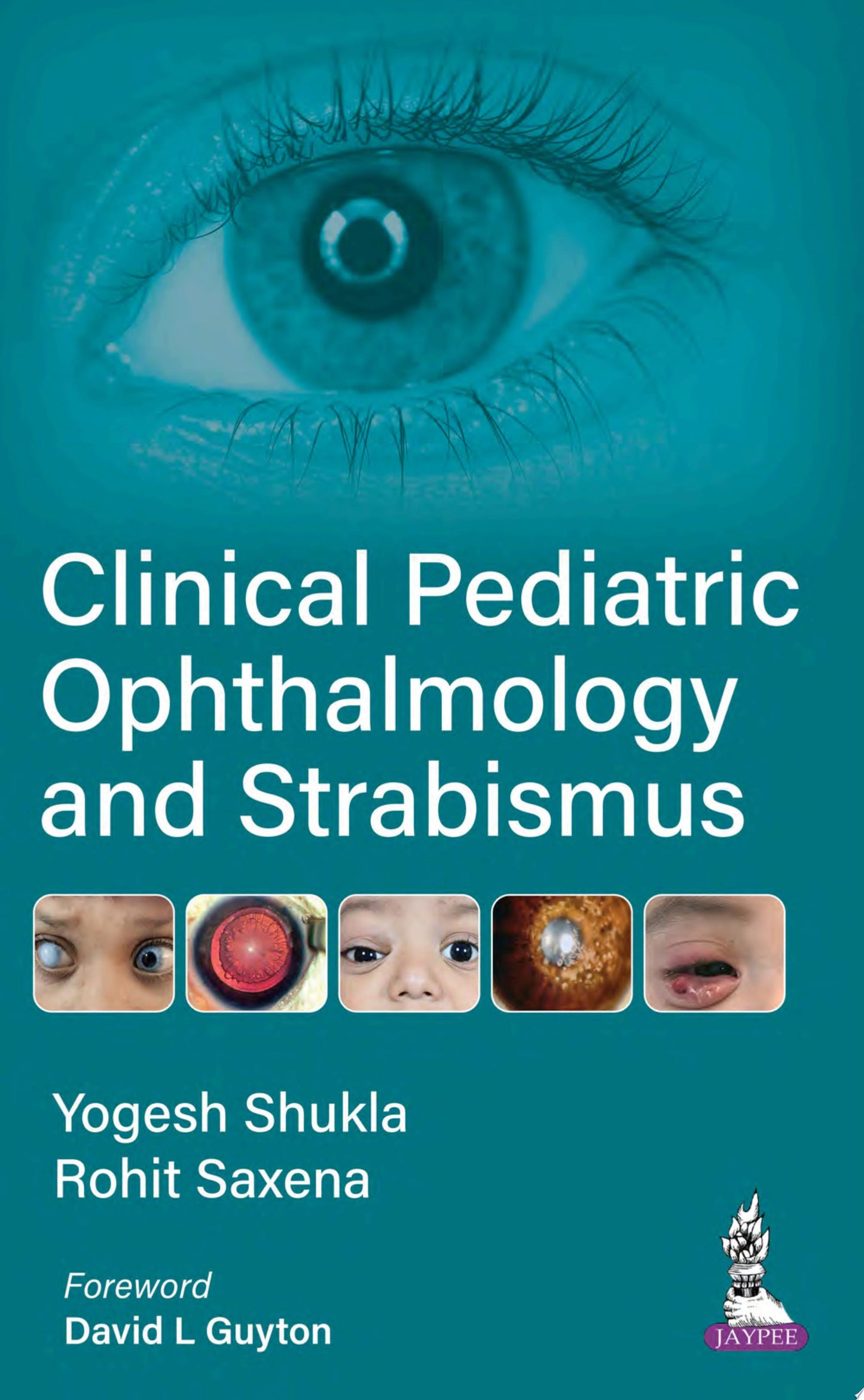 2019-2020 BCSC , Section 13: Refractive Surgery
