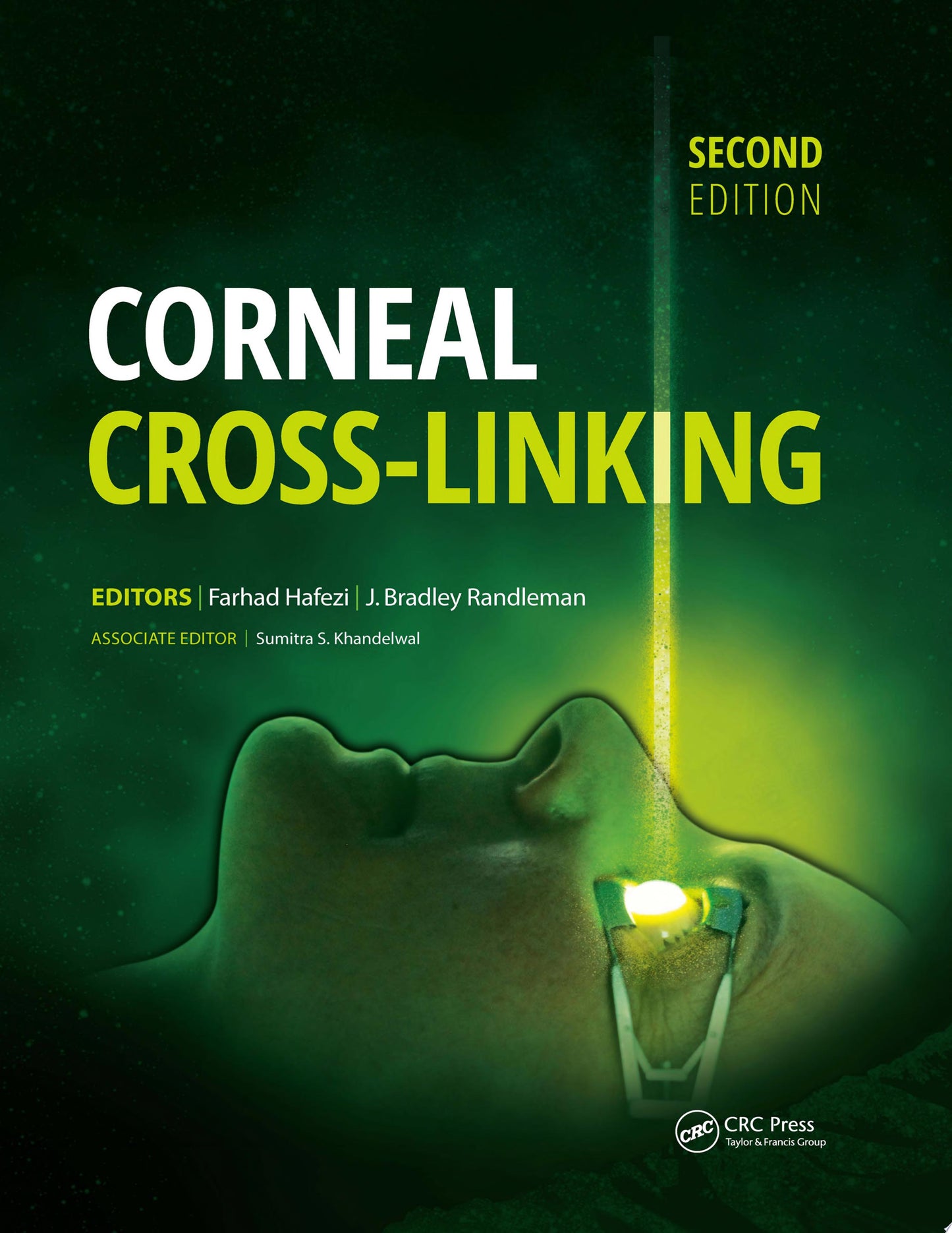 Corneal Collagen Cross Linking