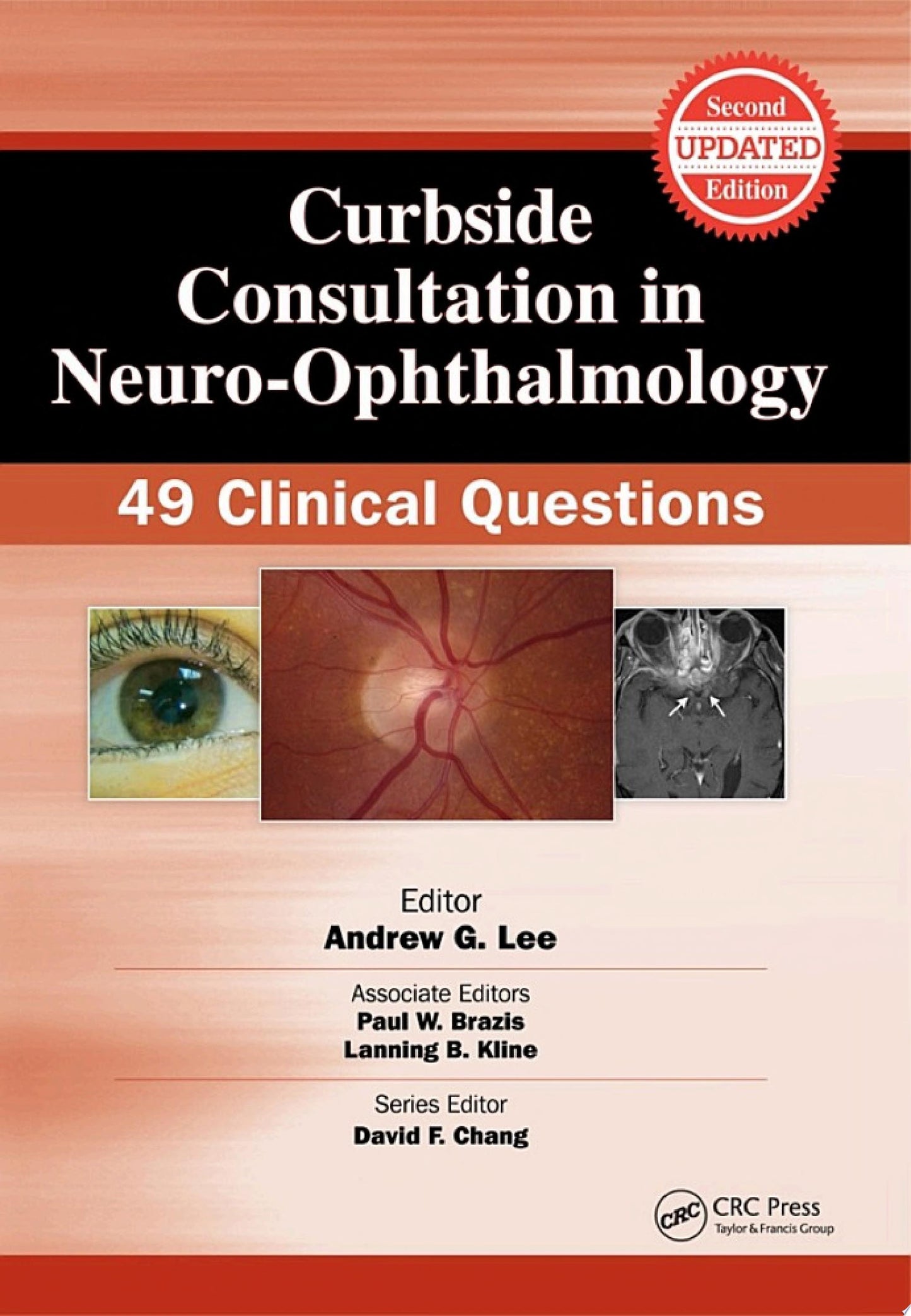 Curbside Consultation in Neuro-Ophthalmology: 49 Clinical Questions, Second Edition