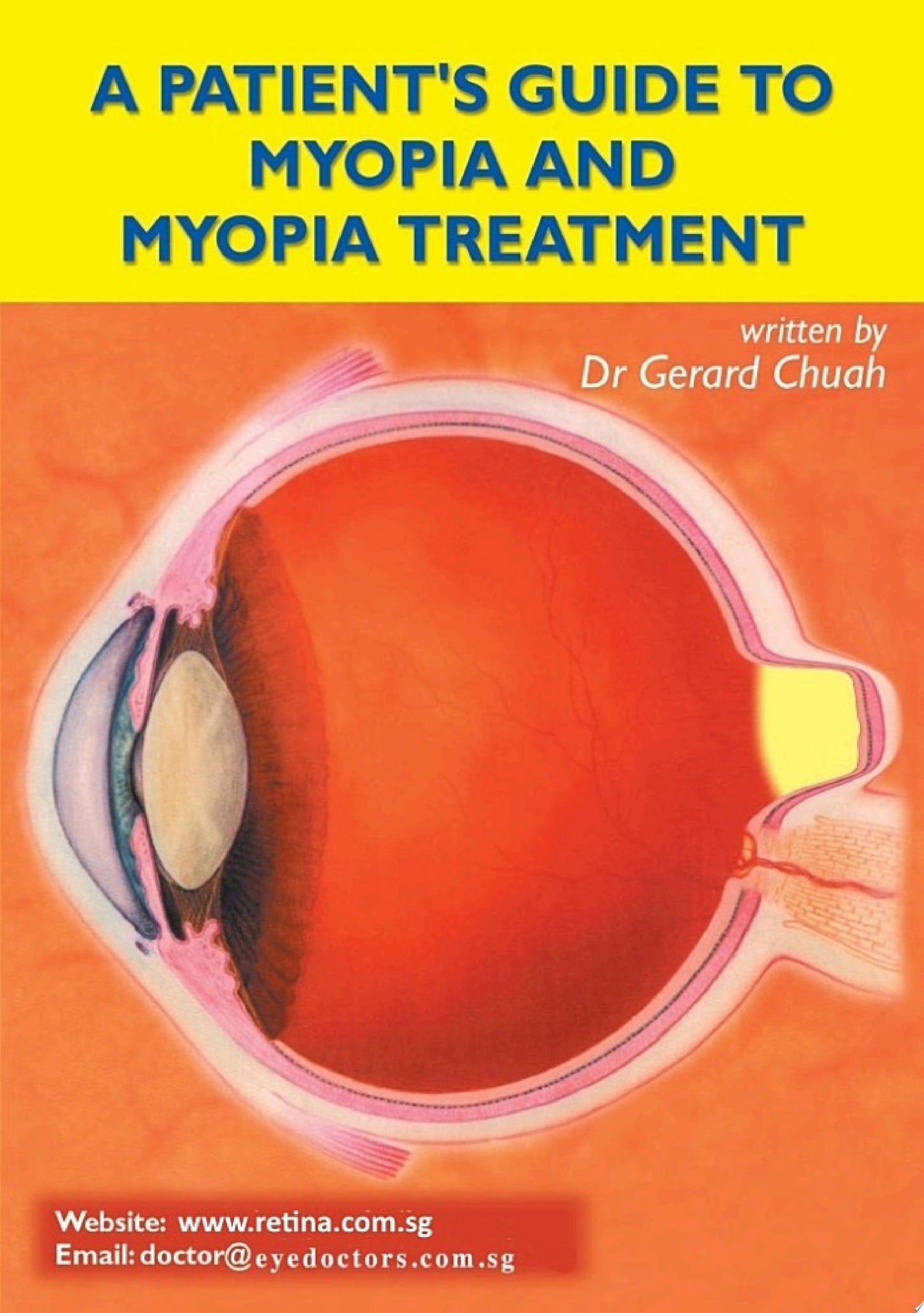 Cataracts: A Patient’s Guide to Treatment, 2nd Edition