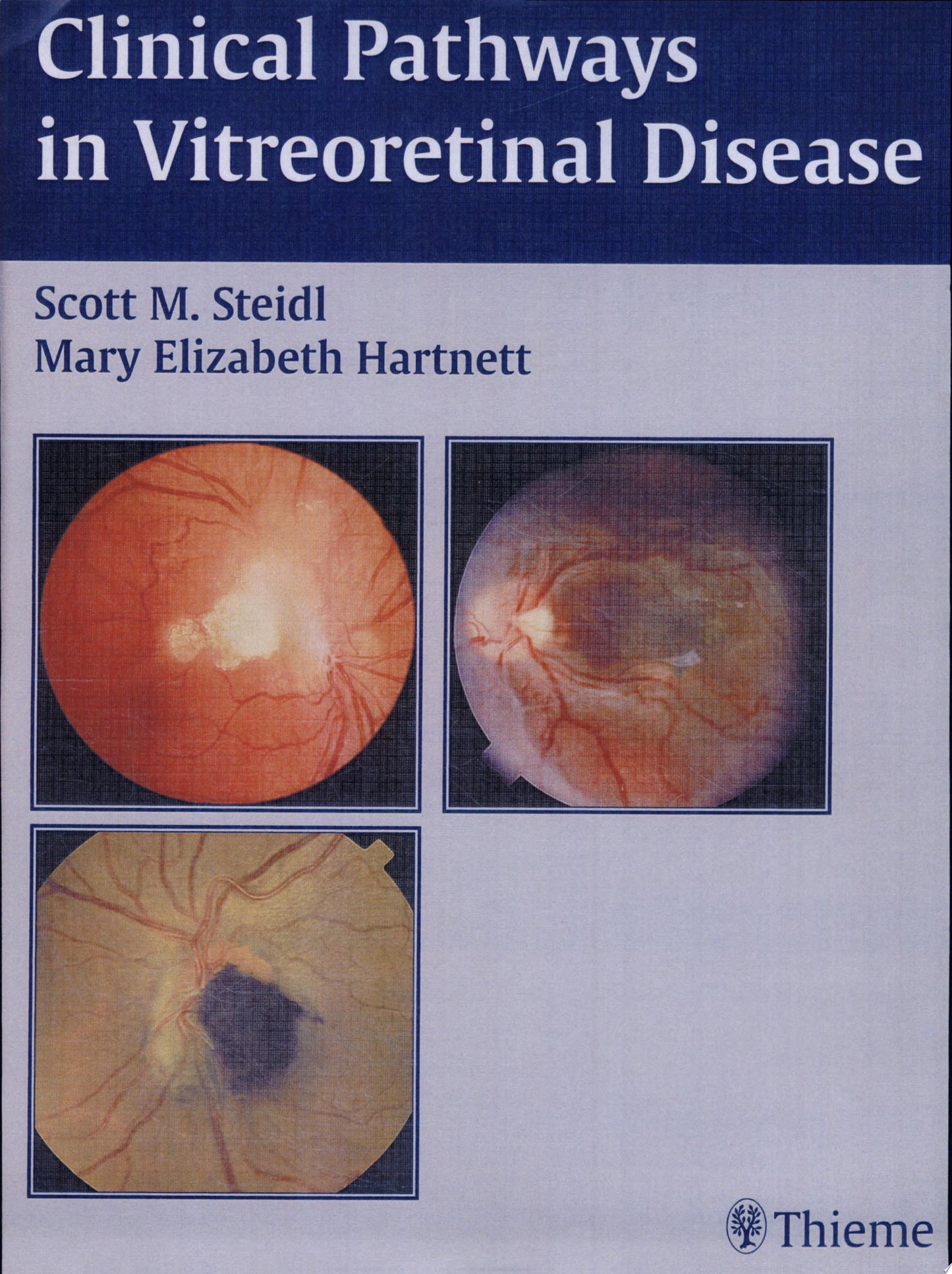 Clinical Pathways In Vitreoretinal Disease