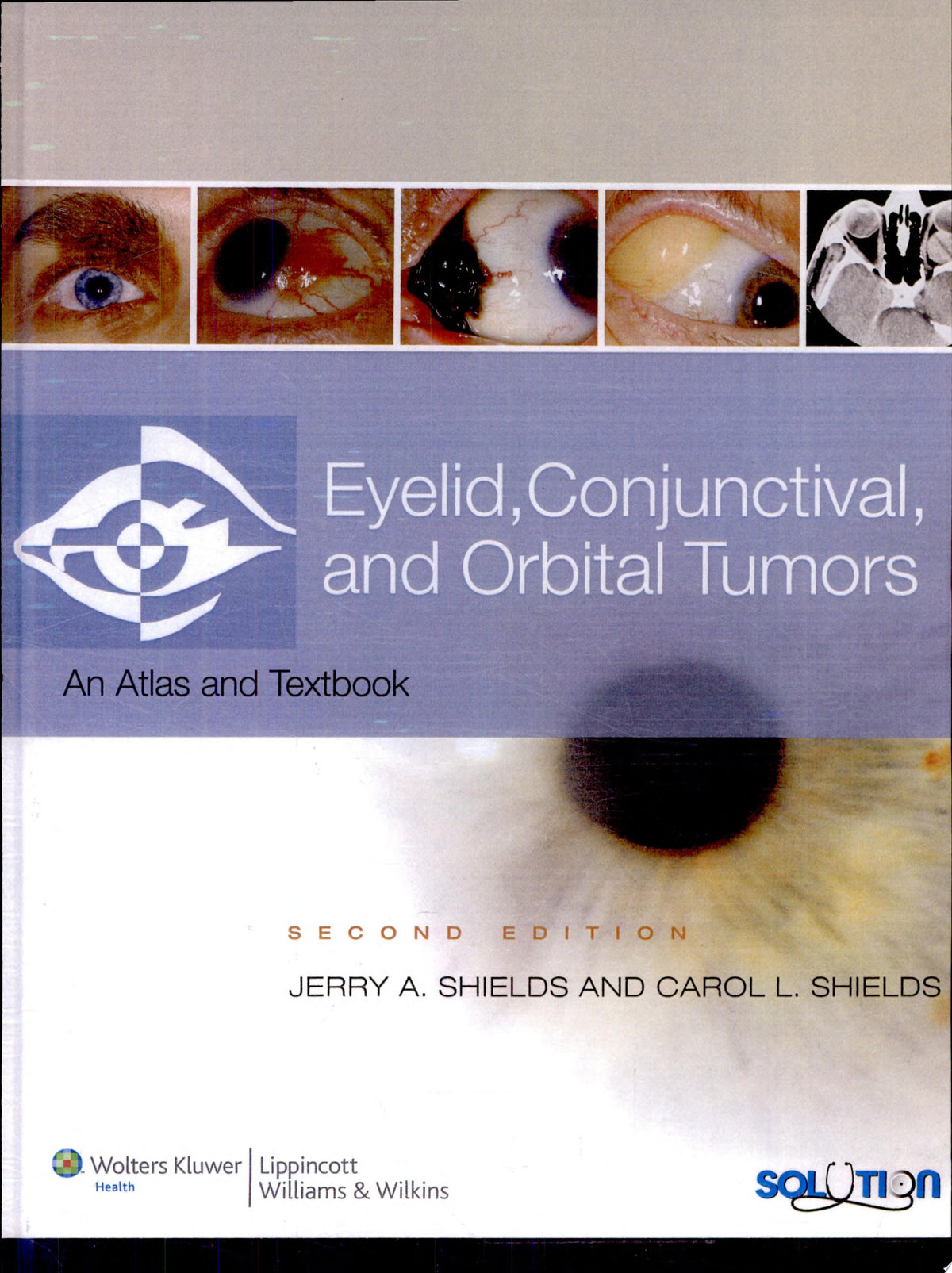 Eyelid, Conjunctival, and Orbital Tumors: An Atlas and Textbook, Third Edition