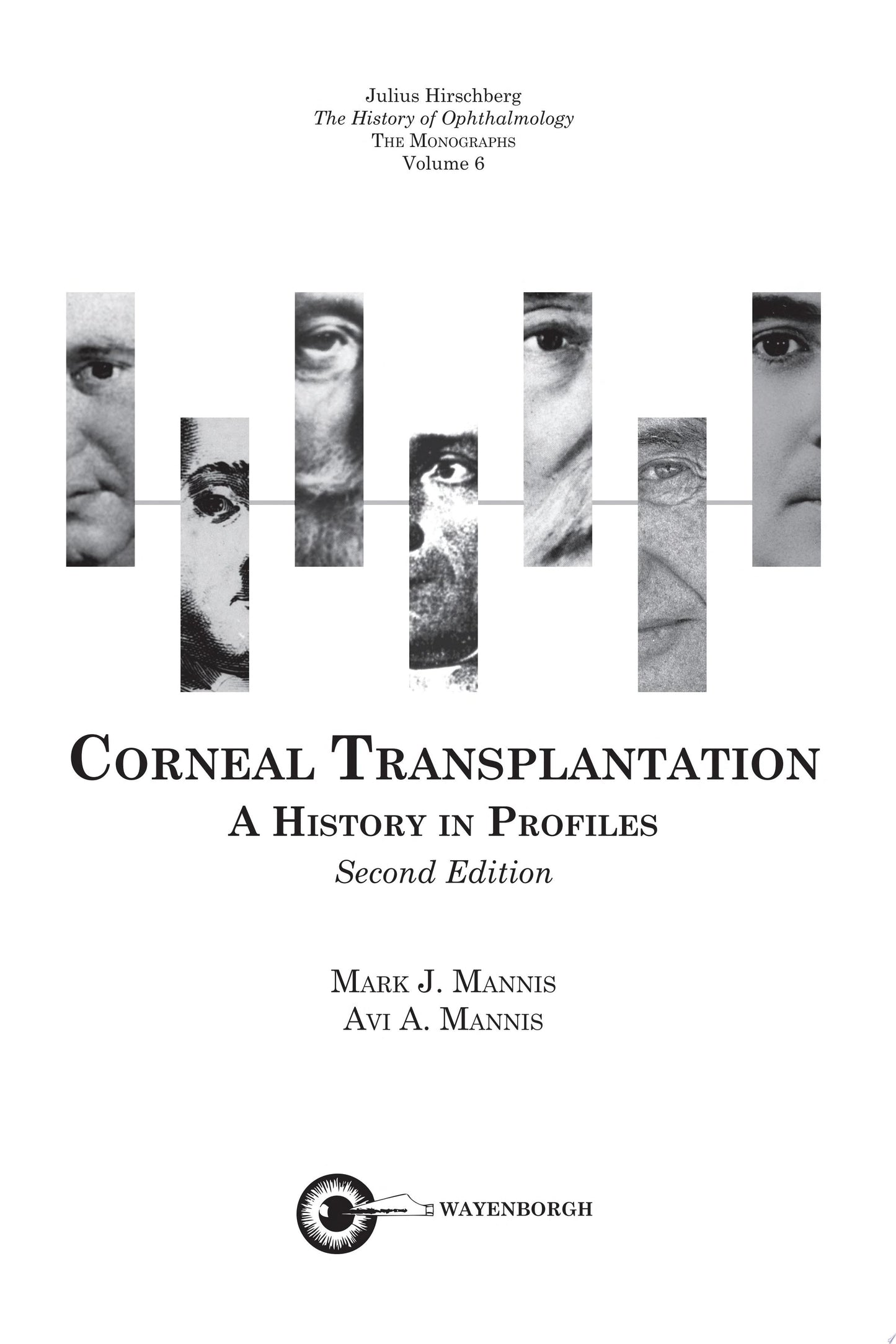 Corneal Transplantation, 3rd edition