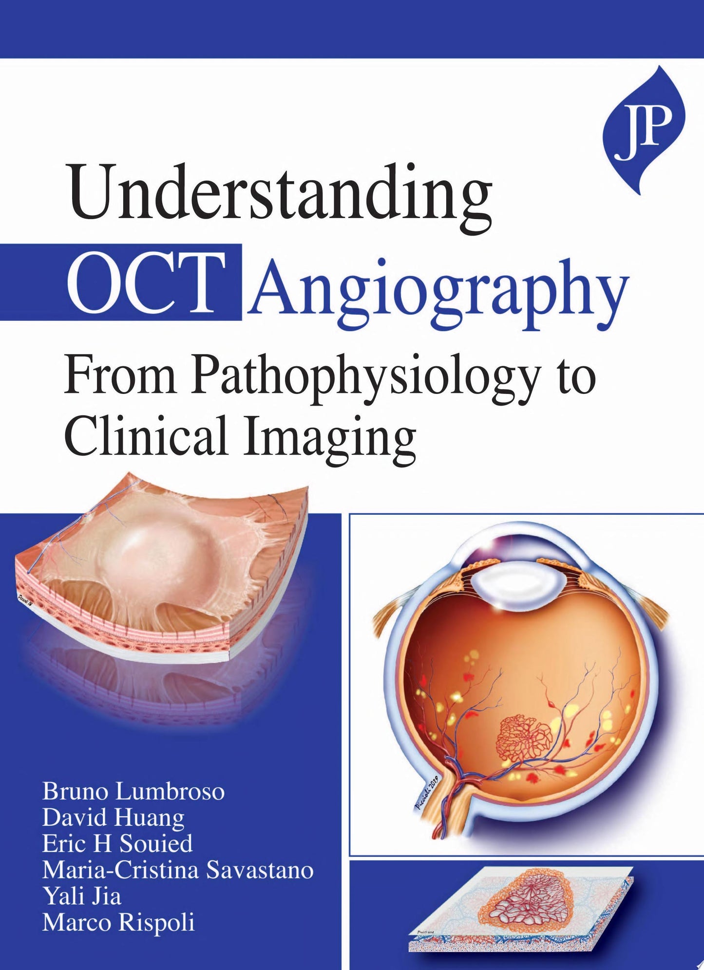 Understanding OCT Angiography from Pathophysiology to Clinical Imaging