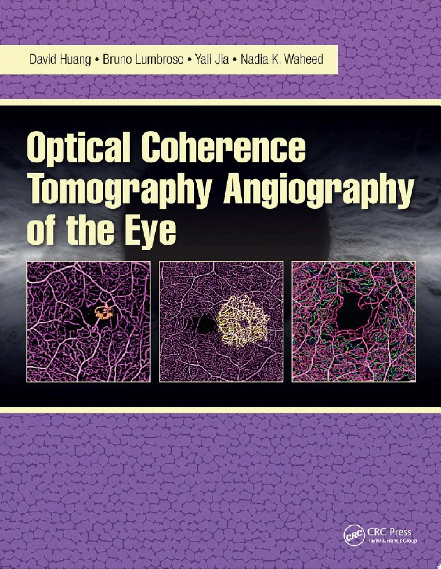Optical Coherence Tomography Angiography of the Eye, 2nd edition
