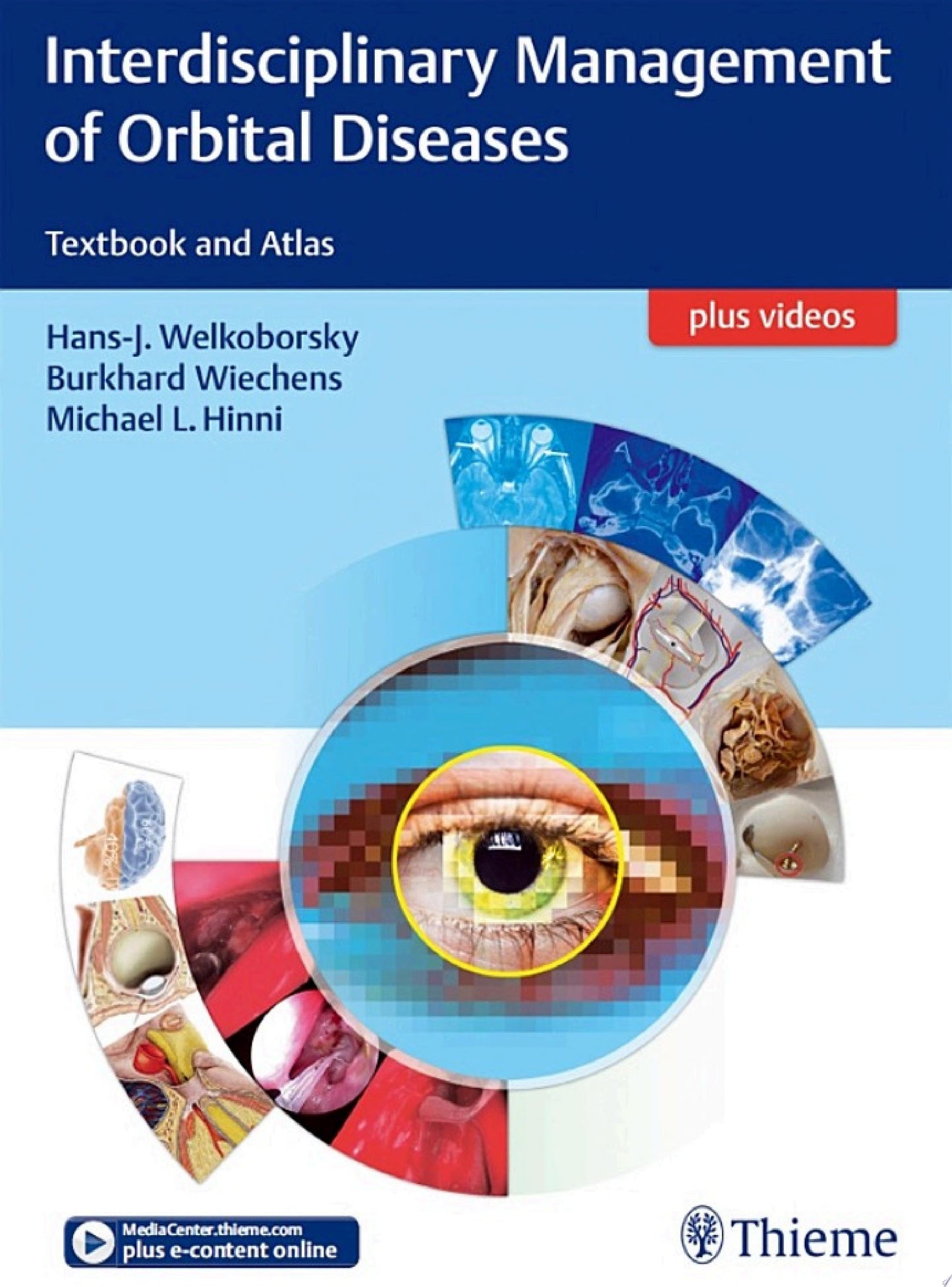 Interdisciplinary Management of Orbital Diseases: Textbook and Atlas,1st edition