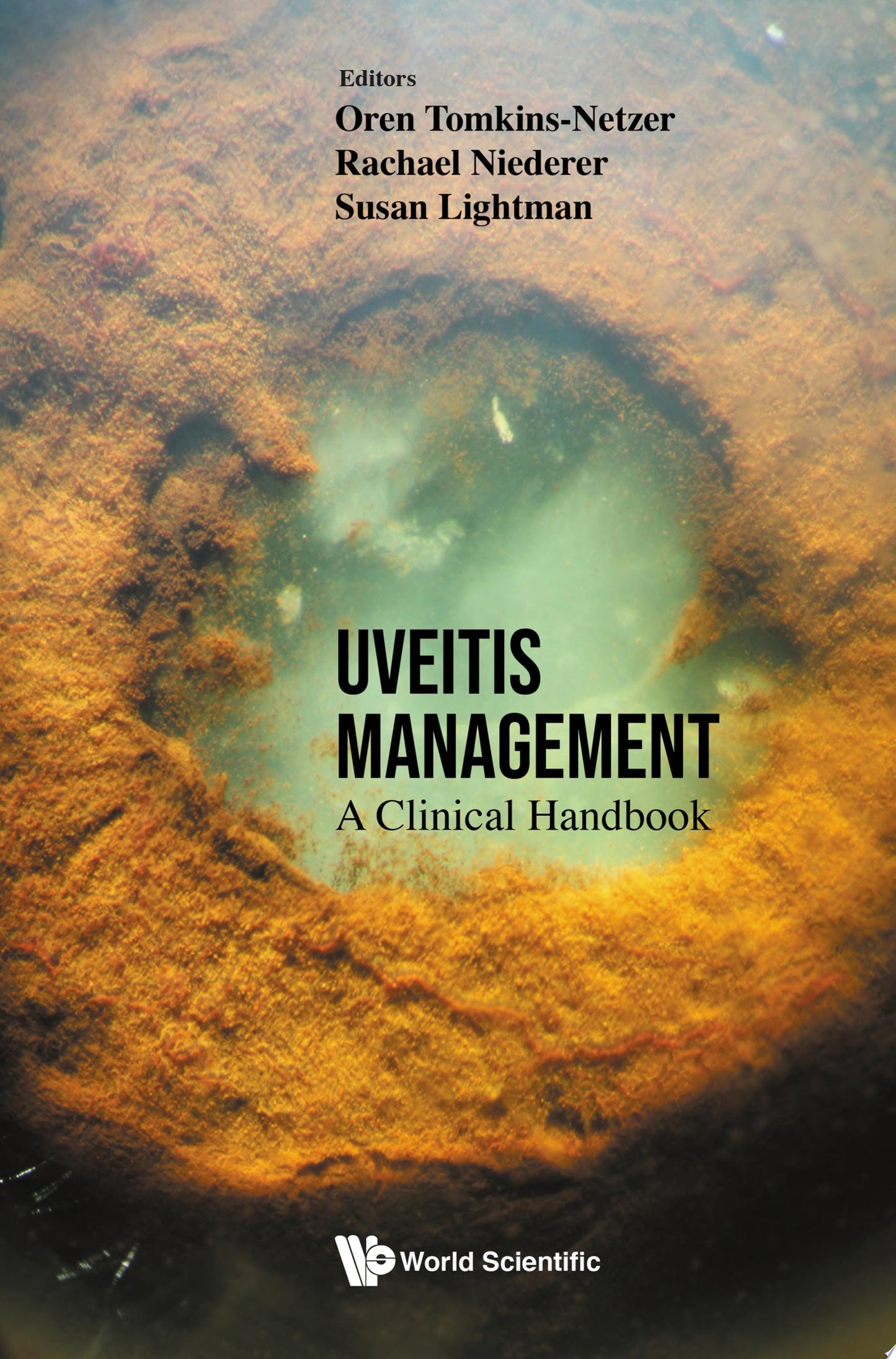 Uveitis Management: A Clinical Handbook