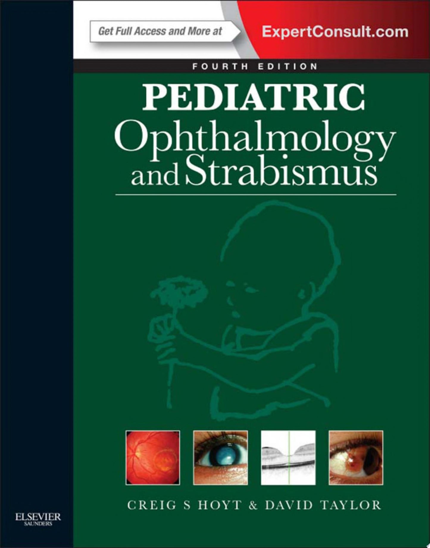 Ocular Pathology: Expert Consult – Online and Print, 7e
