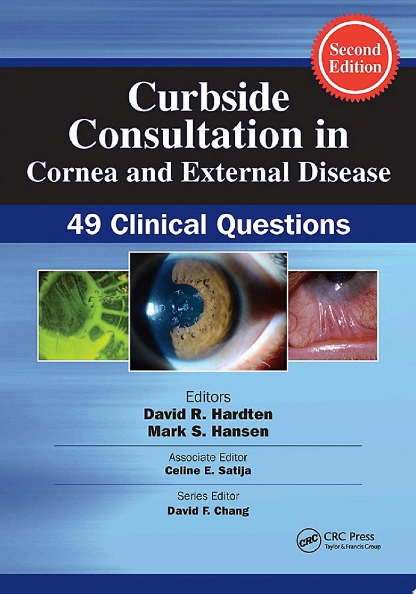 Curbside Consultation in Cornea and External Disease: 49 Clinical Questions, 2nd Edition