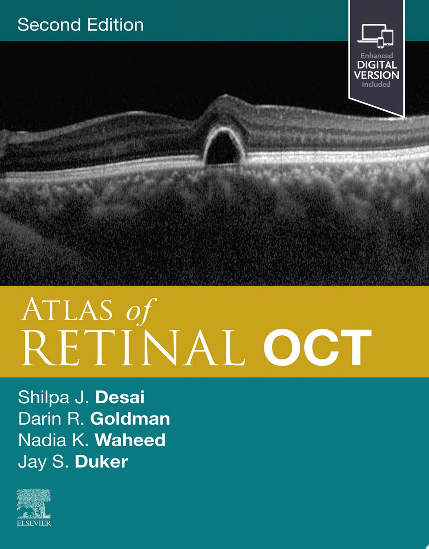 Handbook of Retinal OCT: Optical Coherence Tomography, 2nd Edition
