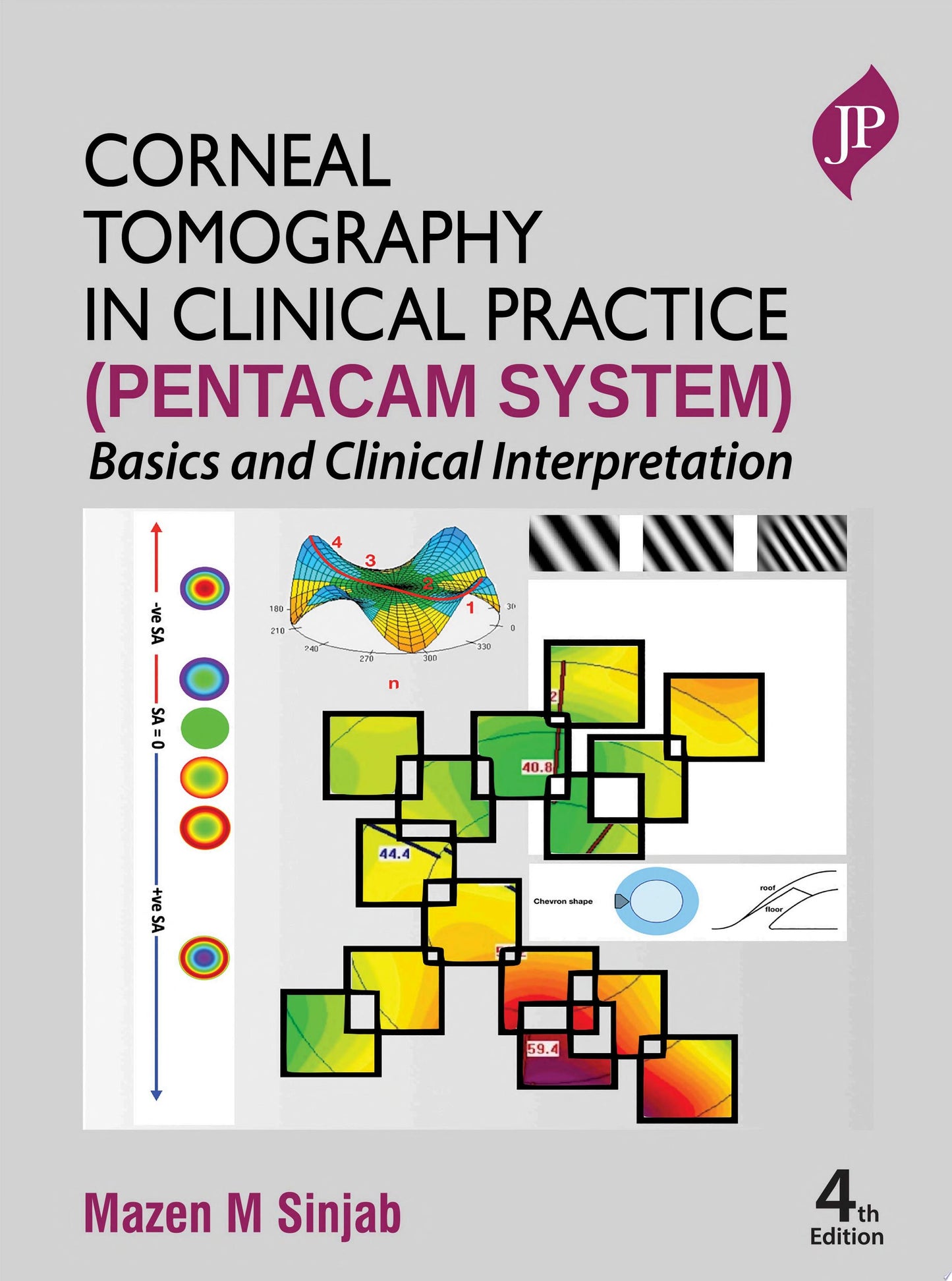 Corneal Tomography in Clinical Practice : Basics and Clinical Interpretation, 4th Edition