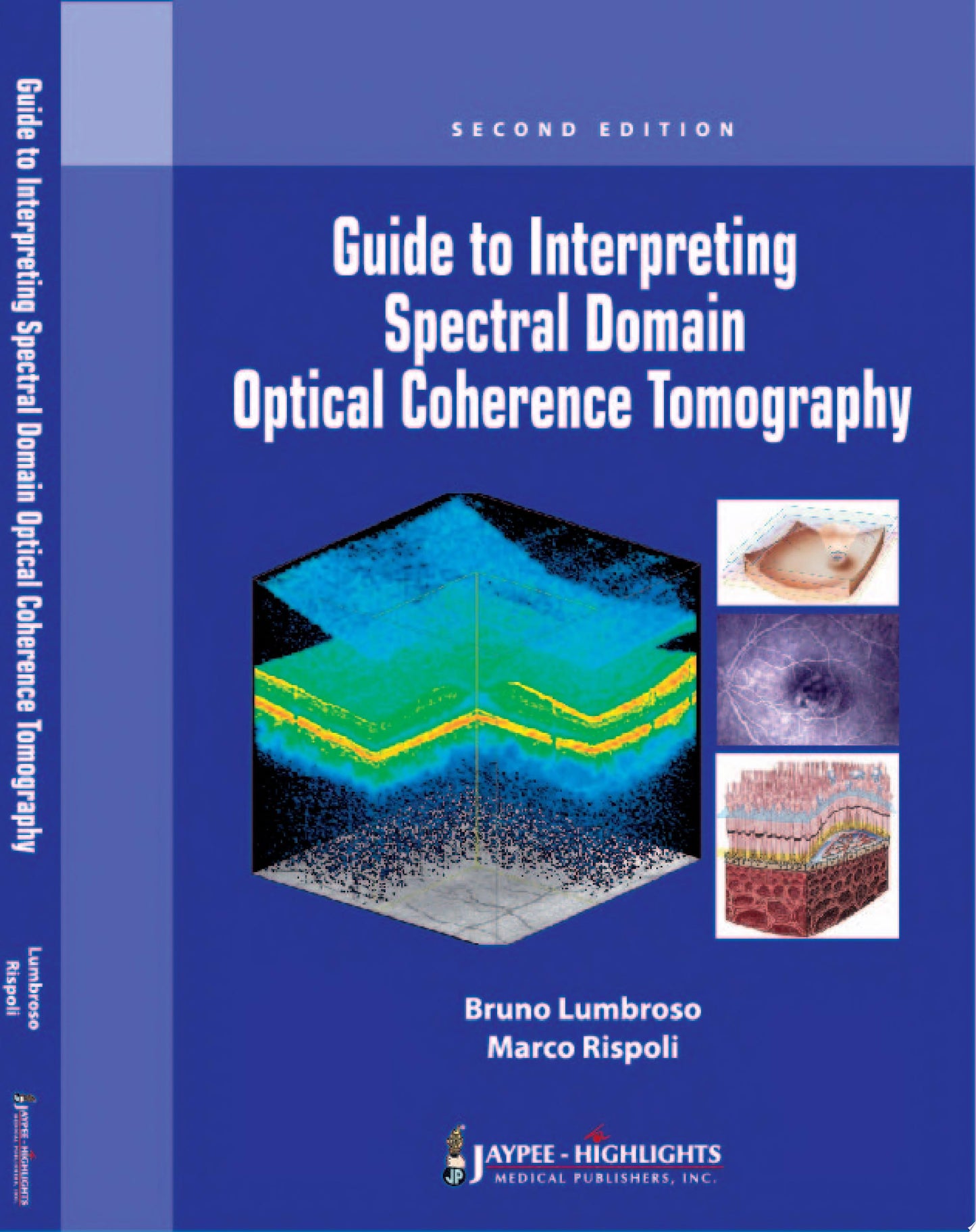 Spectral Domain OCT