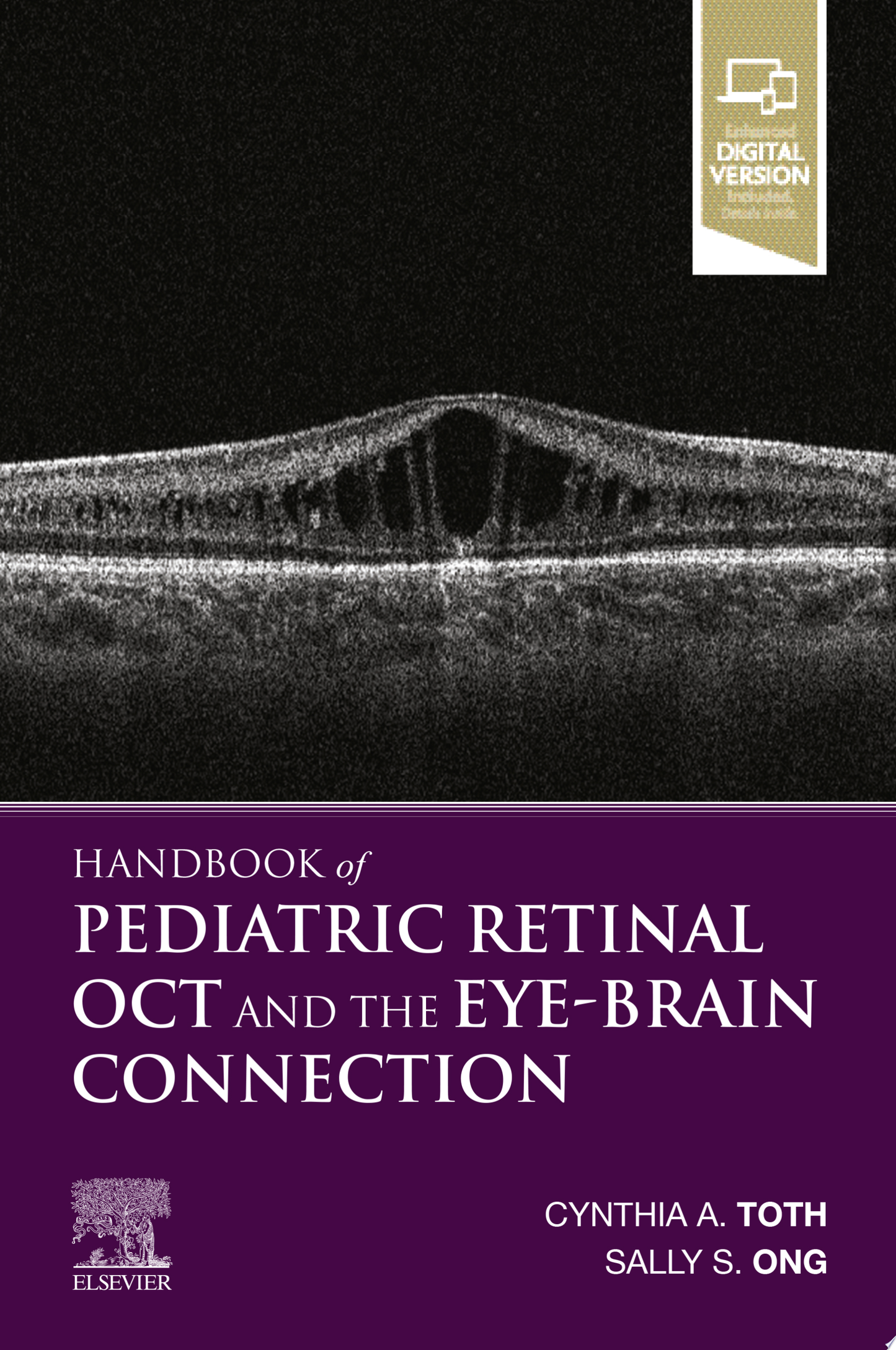 Handbook of Pediatric Retinal OCT and the Eye-Brain Connection