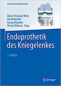 Endoprothetik des Kniegelenkes , 2nd Edition