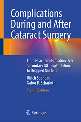 Complications During and After Cataract Surgery: From Phacoemulsification Over Secondary IOL Implantation to Dropped Nucleus, 2nd Edition