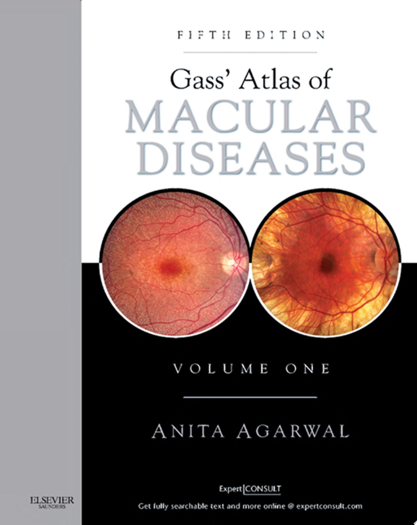 Gass’ Atlas of Macular Diseases: 2-Volume Set, 5th Edition