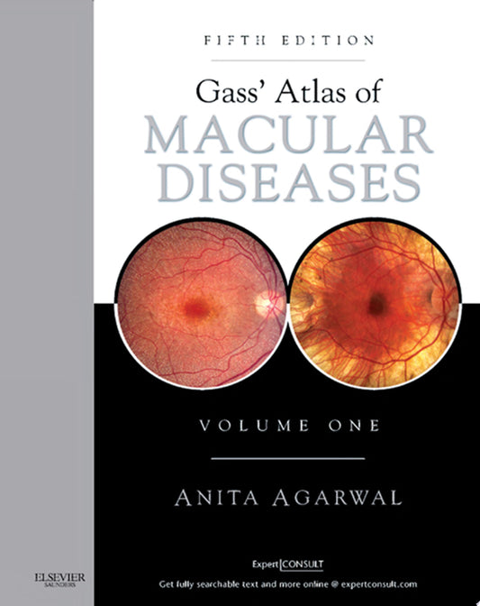 Gass’ Atlas of Macular Diseases: 2-Volume Set, 5th Edition