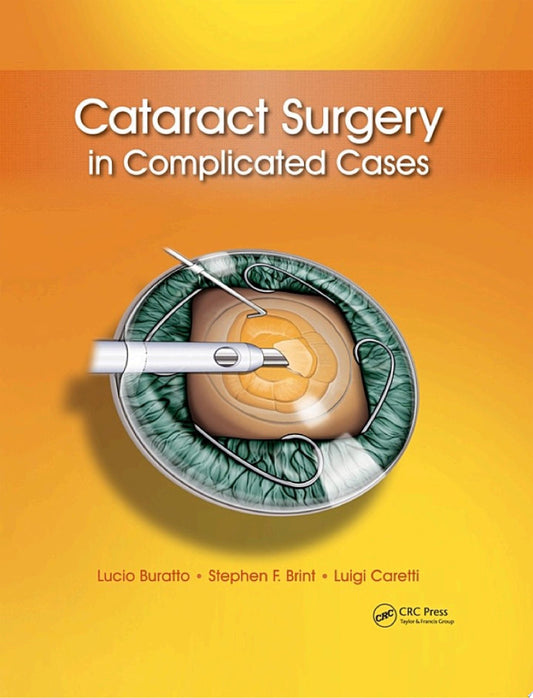 Cataract Surgery in Complicated Cases