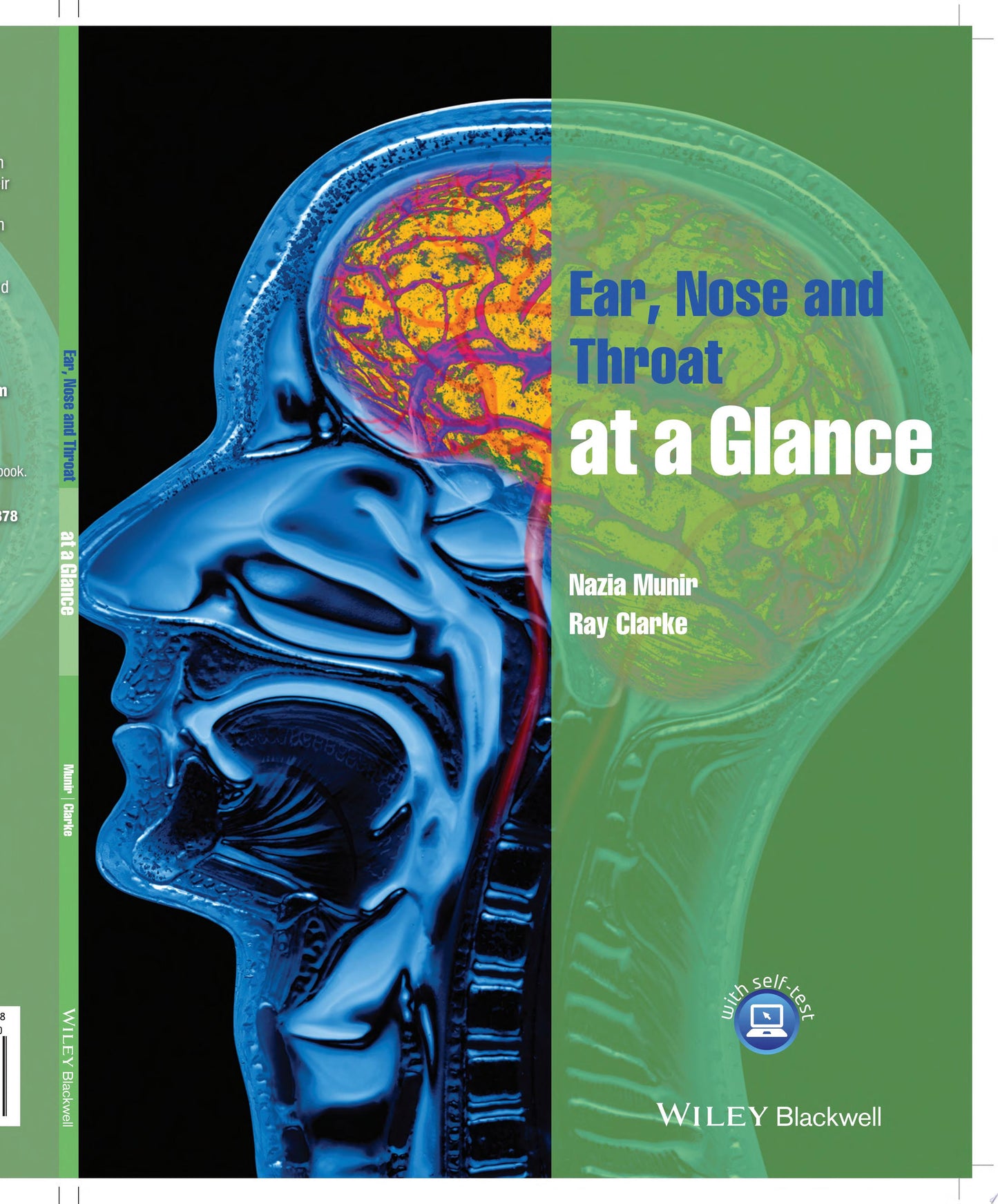 Lecture Notes: Ophthalmology, 11th Edition