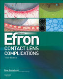 Contact Lens Complications, 3rd Edition