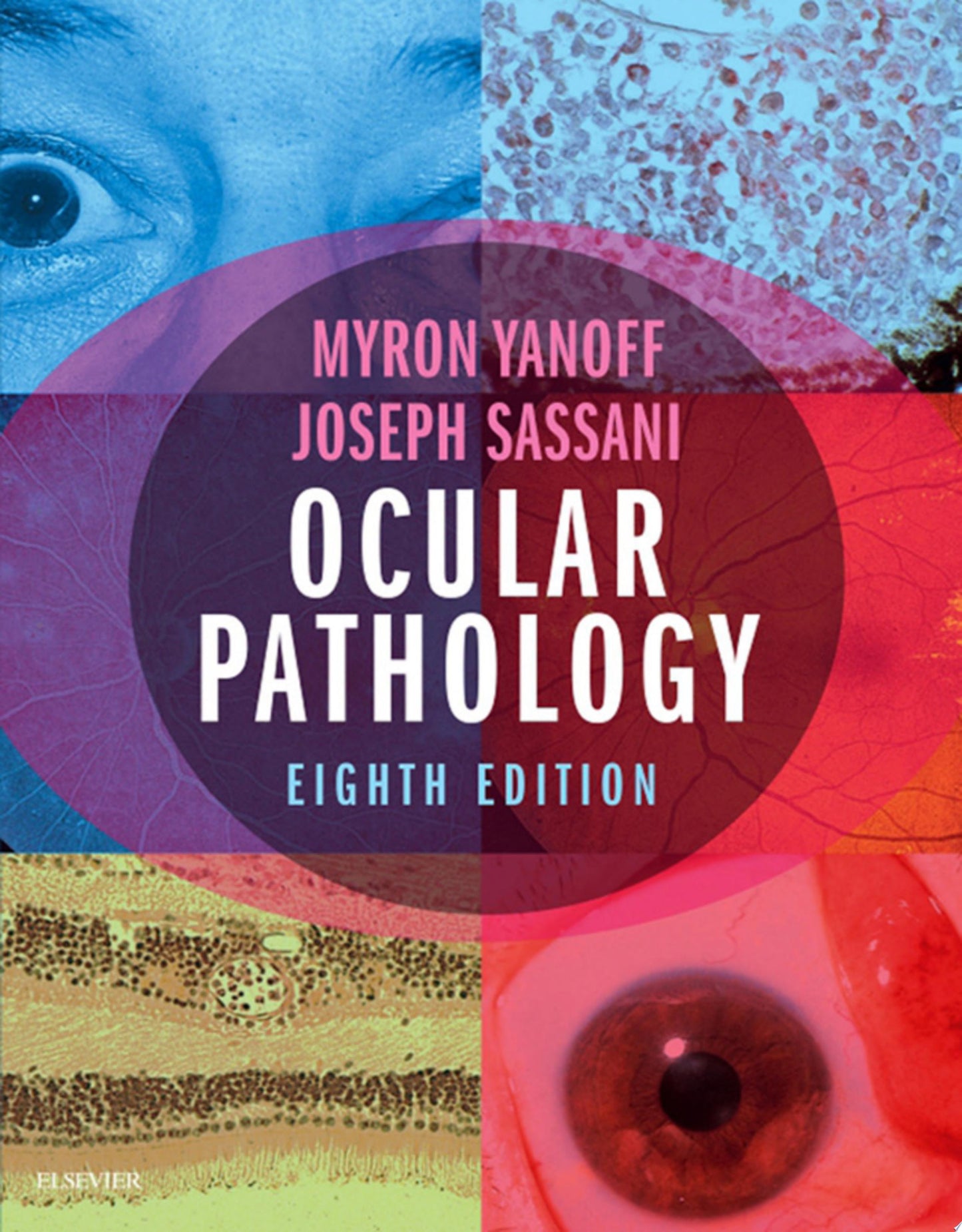 Ocular Pathology, 8th Edition