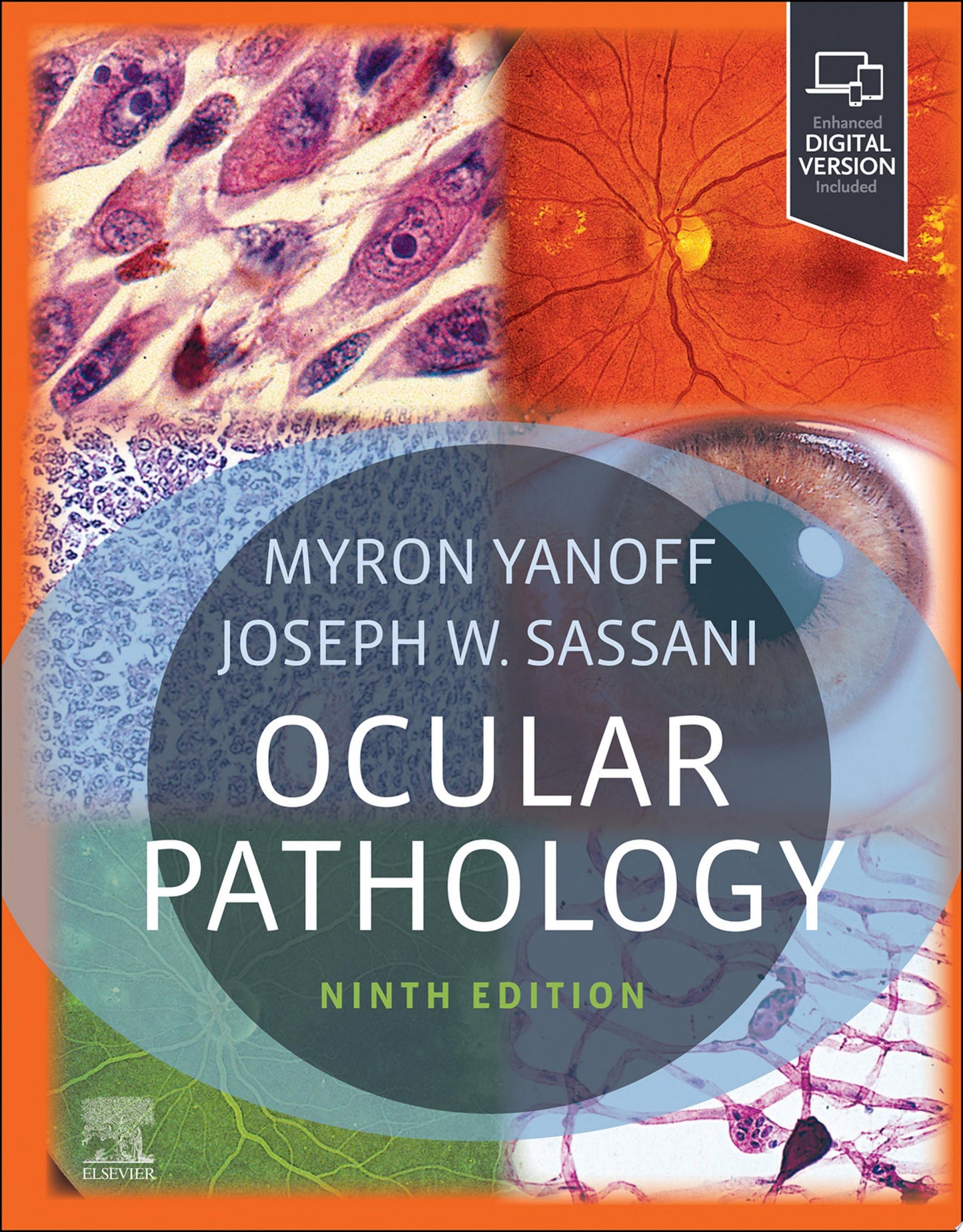Ocular Pathology, 9th edition