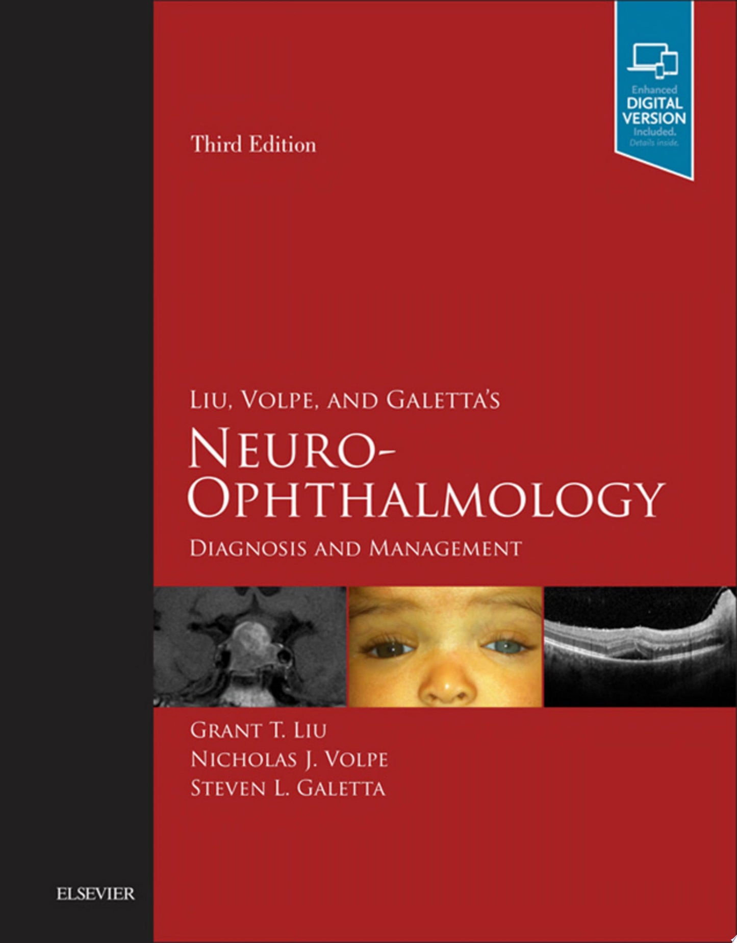 Liu, Volpe, and Galetta’s Neuro-Ophthalmology: Diagnosis and Management, 3rd Edition