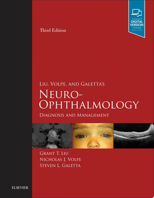 Liu, Volpe, and Galetta’s Neuro-Ophthalmology: Diagnosis and Management, 3rd Edition