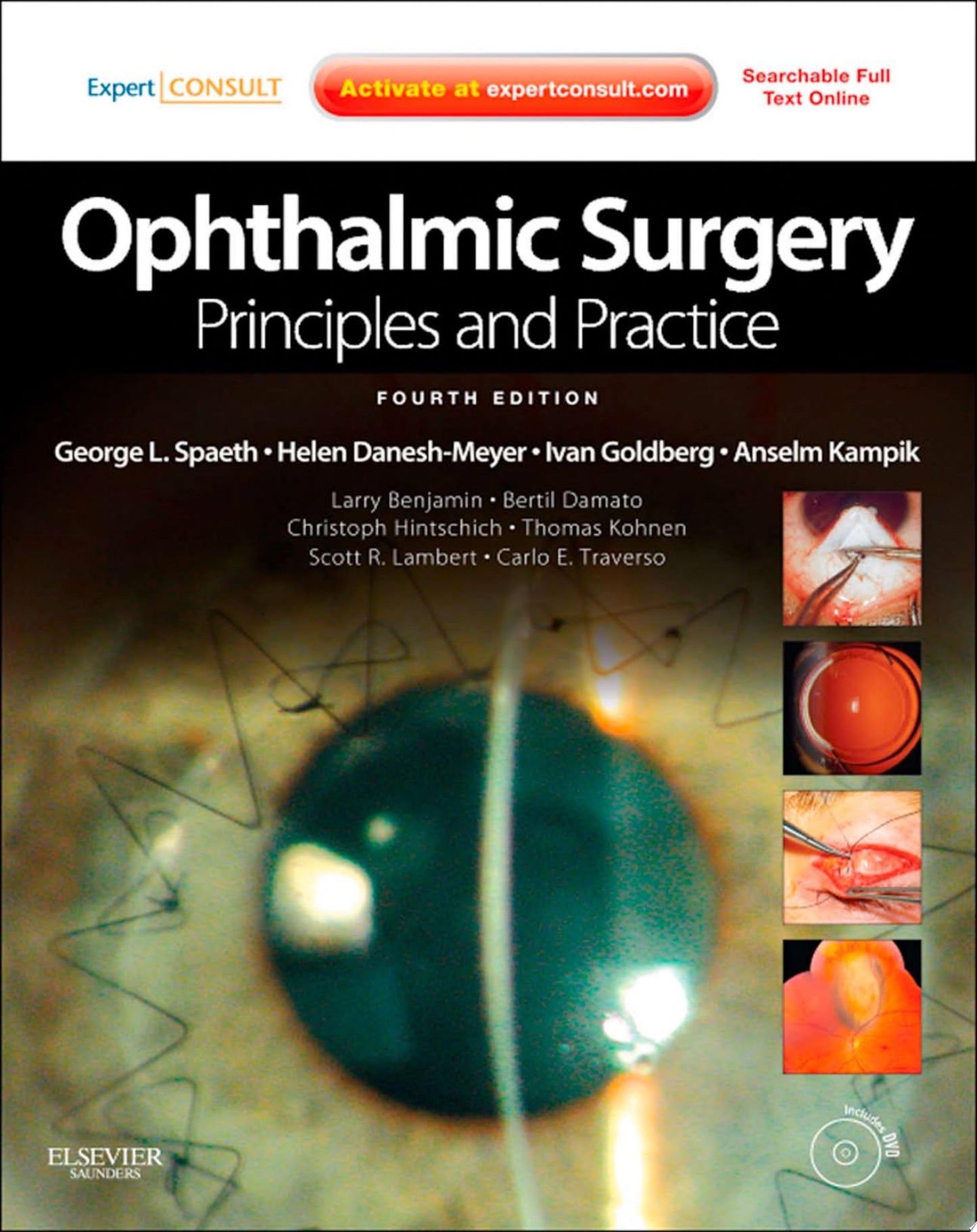 Ophthalmic Surgery: Principles and Practice, 4th Edition