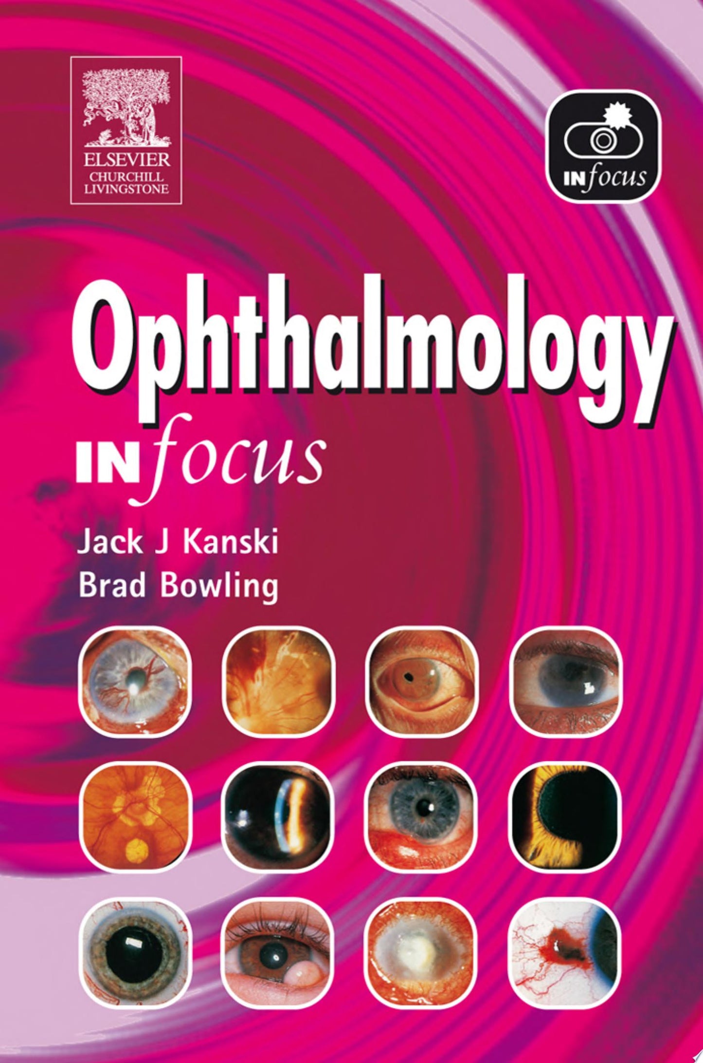 Ophthalmology In Focus