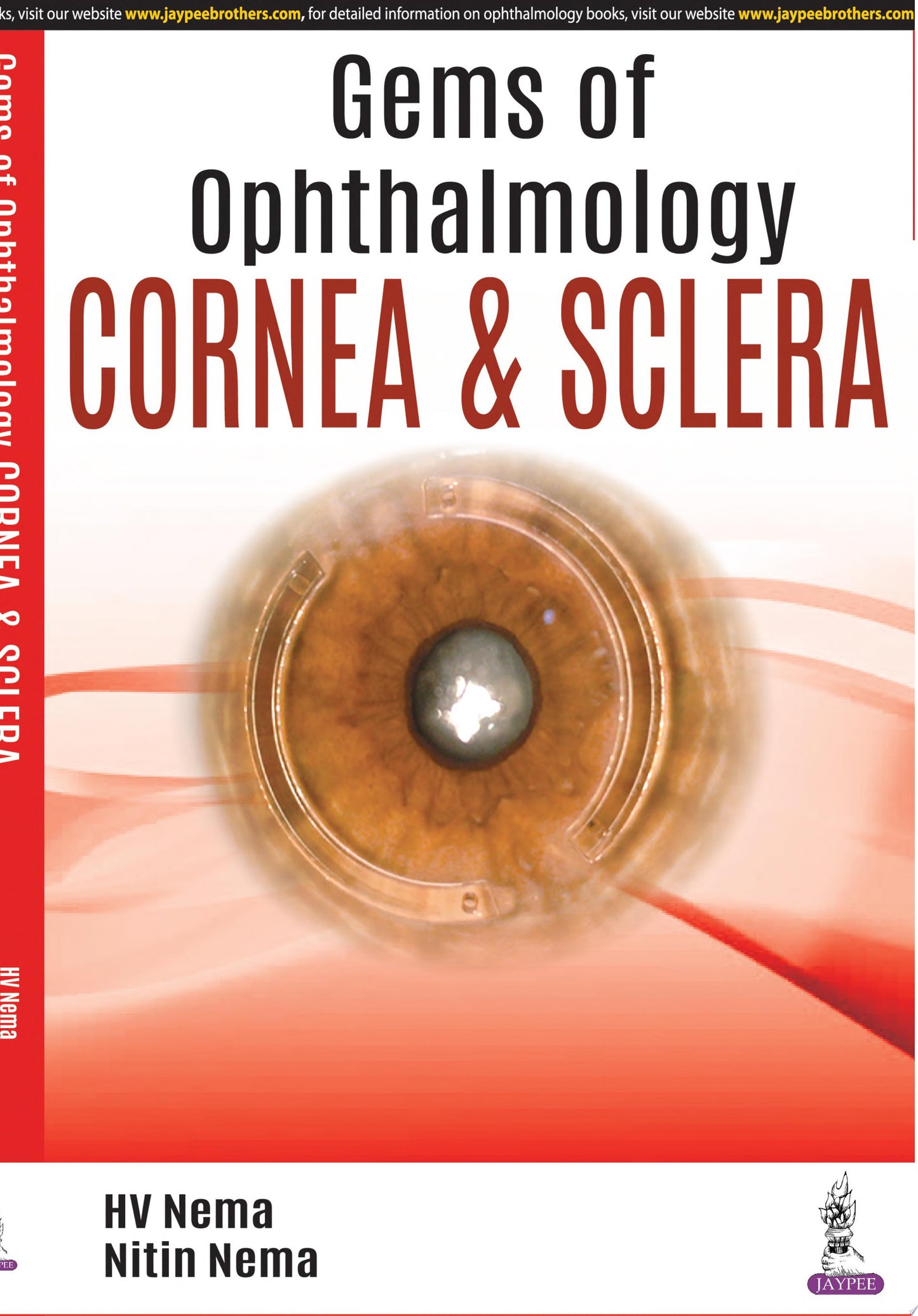 Gems of Ophthalmology-Cornea and Sclera