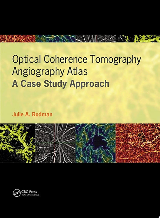 Optical Coherence Tomography Angiography Atlas