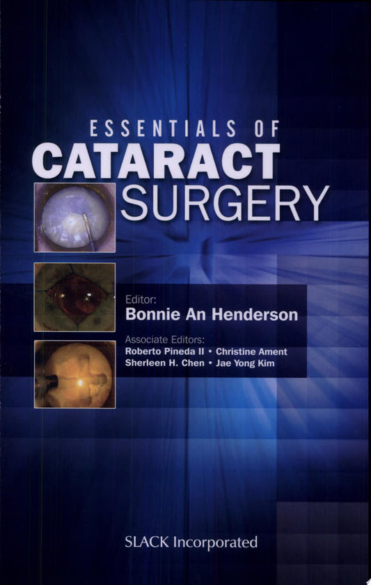Essentials of Cataract Surgery, 2nd Edition