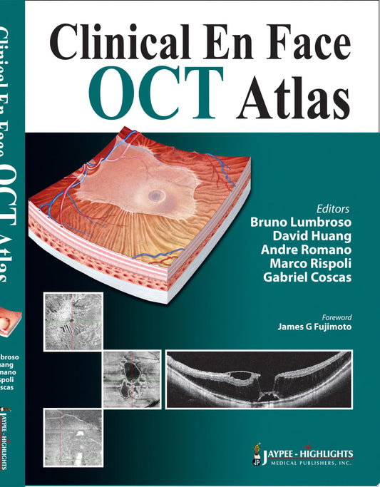 OCT Atlas