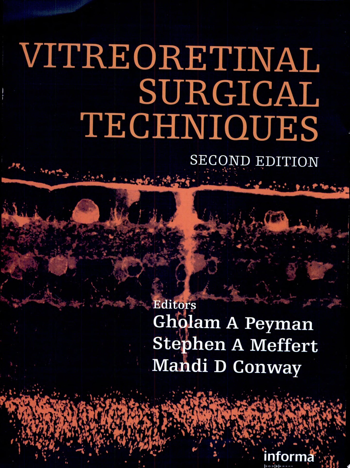 Age-Related Macular Degeneration, 2nd Edition