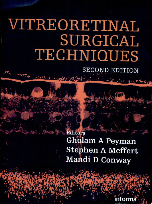 Age-Related Macular Degeneration, 2nd Edition