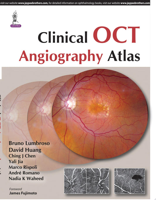 Clinical OCT Angiography Atlas