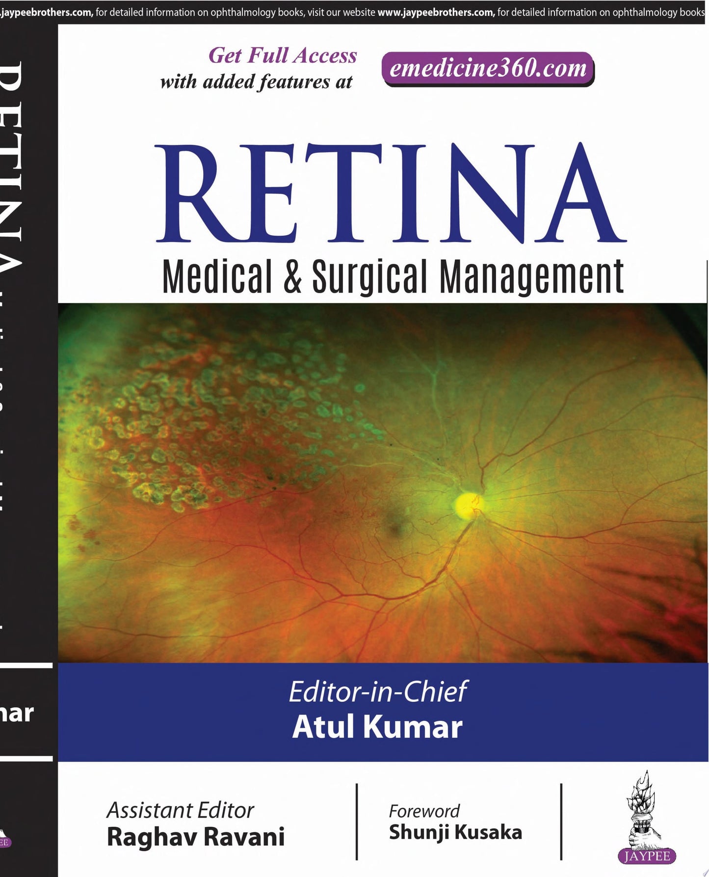 Retina: Medical and Surgical Management: Ophthalmology