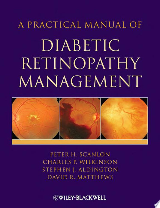 A Practical Manual of Diabetic Retinopathy Management, 2nd Edition