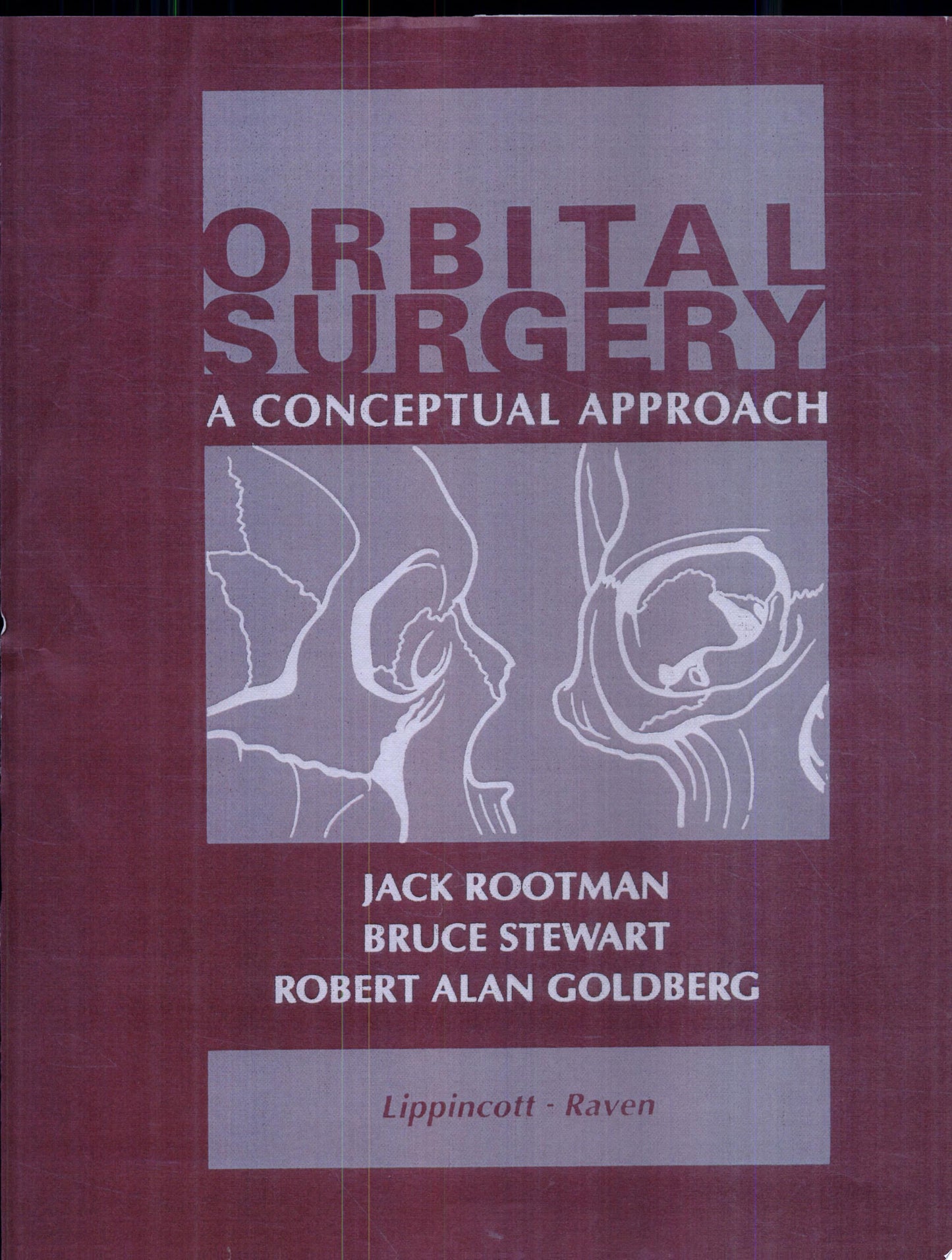 Orbital Surgery